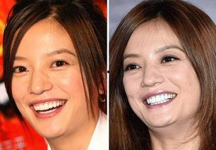 明星网红做假牙视频,揭秘明星美牙秘密