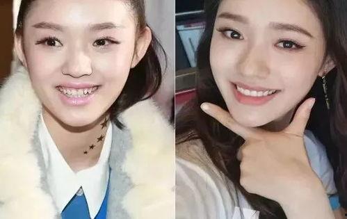 明星网红同款牙缸,明星同款口腔护理新潮流